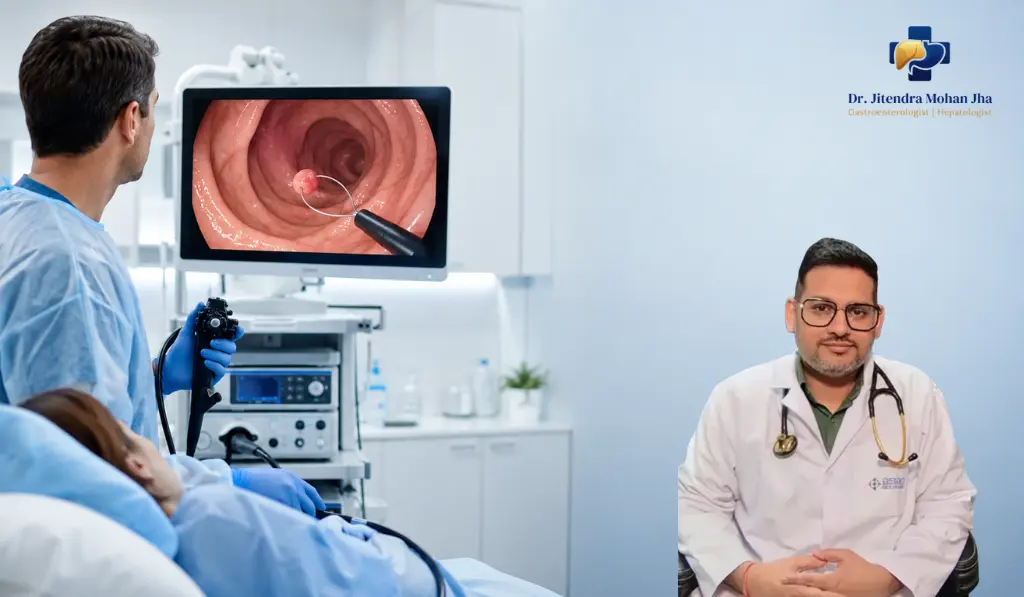 Best Polypectomy Centre in Patna