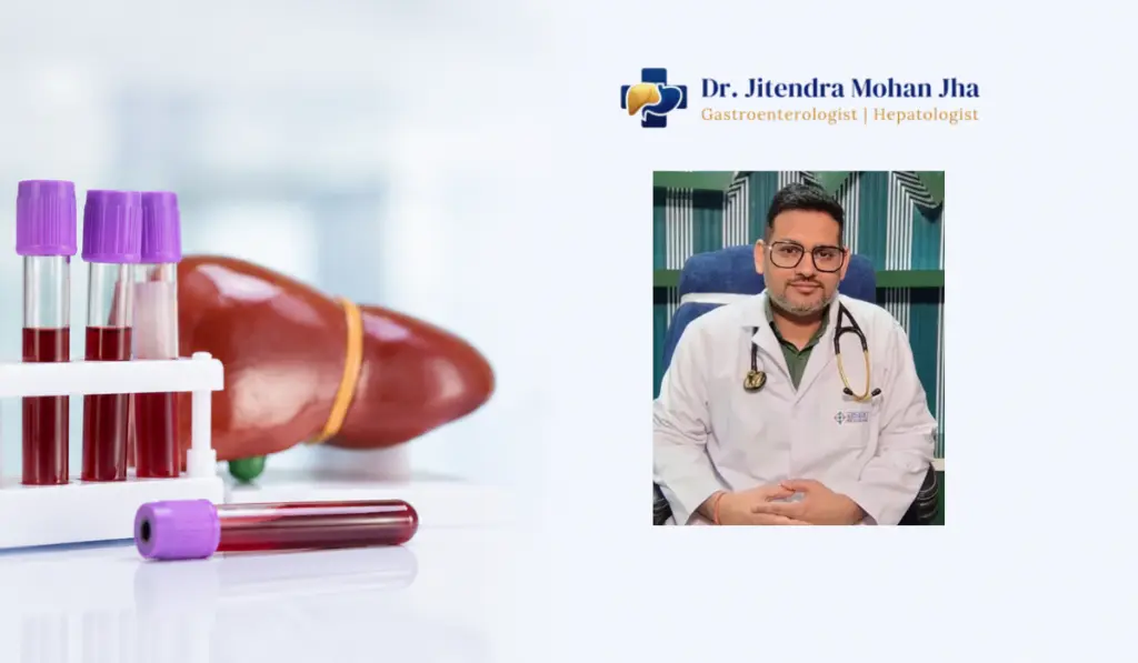 Best LFT Test and Doctor in Patna