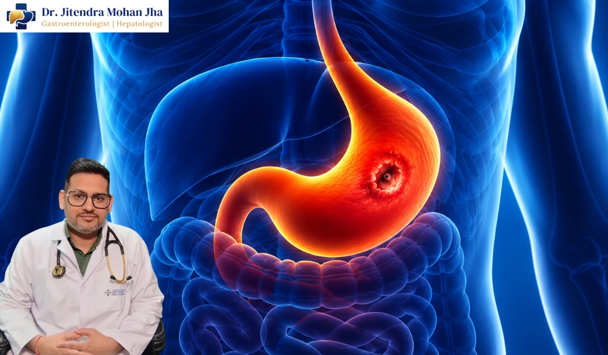 upper and lower gi bleeding treatment in patna