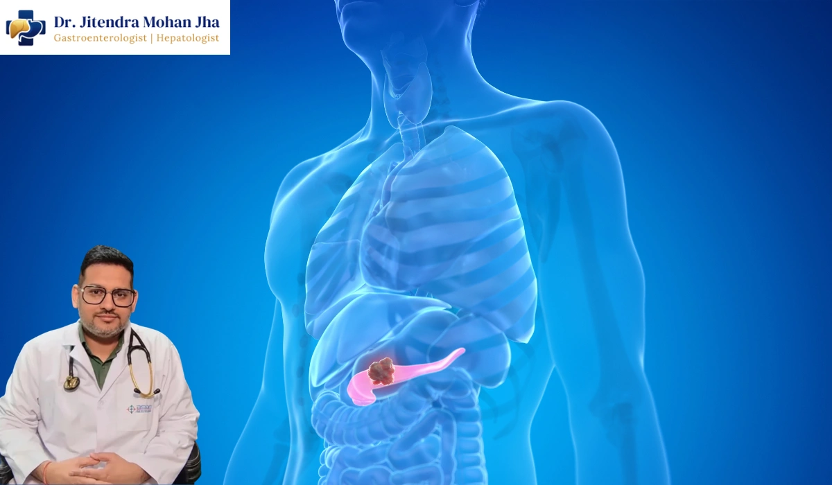 Pancreatitis Treatment in Patna